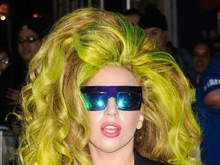 Lady Gaga recuperating after dental surgery
