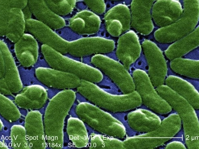Neary 30 in Texas have flesh-eating bacteria